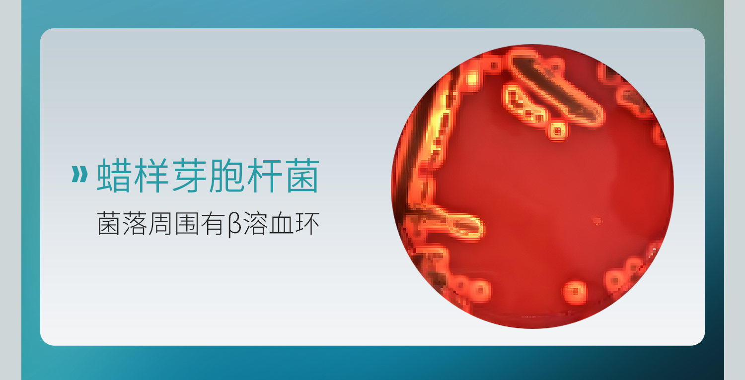 BKM+血琼脂平板_18.jpg